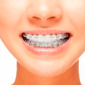 Oral Irrigator